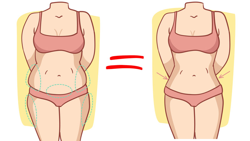 Our 360 liposuction gives rapid and dramatic results.