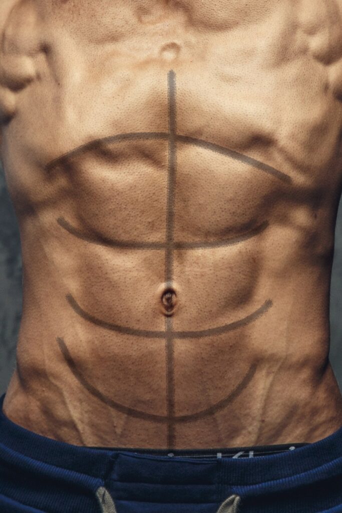 Male Ab Etching and High-Definition Liposuction in Miami, FL