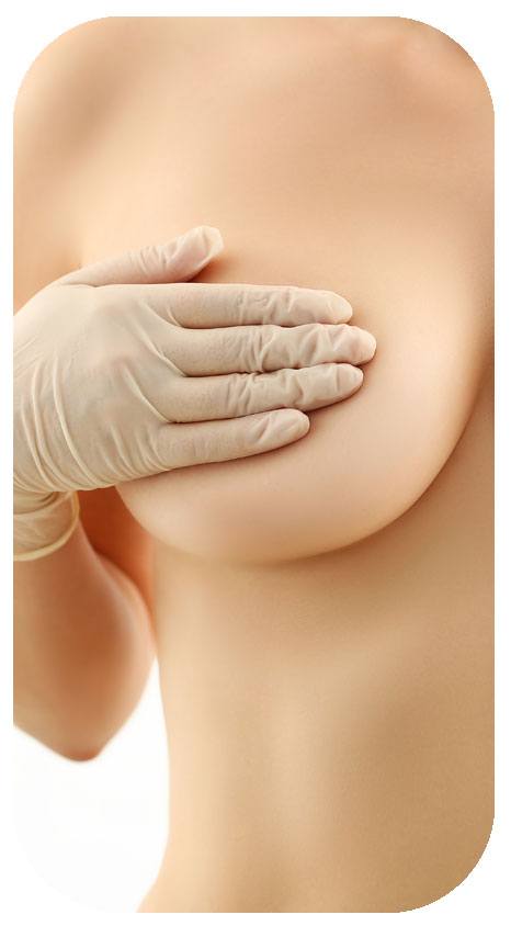 Natural Breast Lift Without Incisions or Implants - Miami Breast