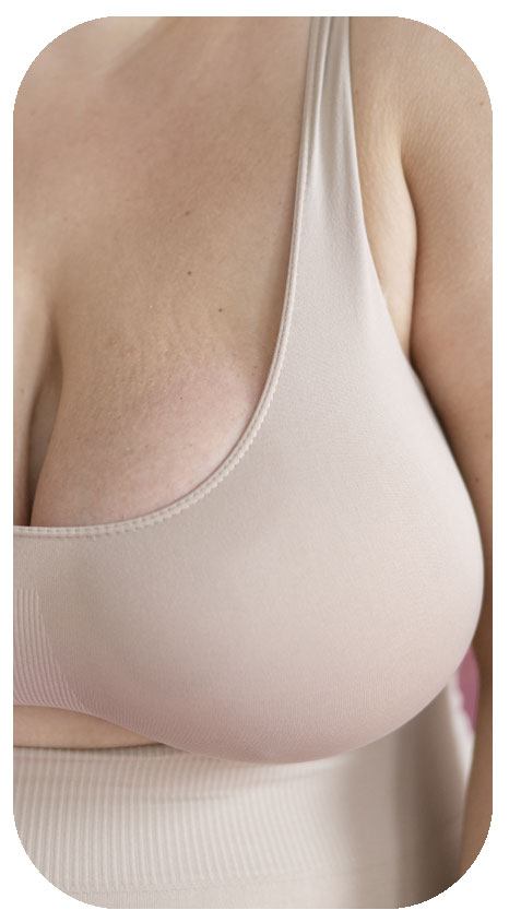 ▷Breast Augmentation Everything you Need to Know