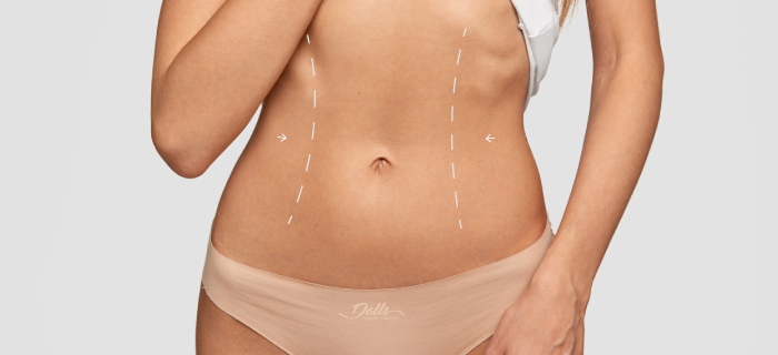 Best lipo 360 miami