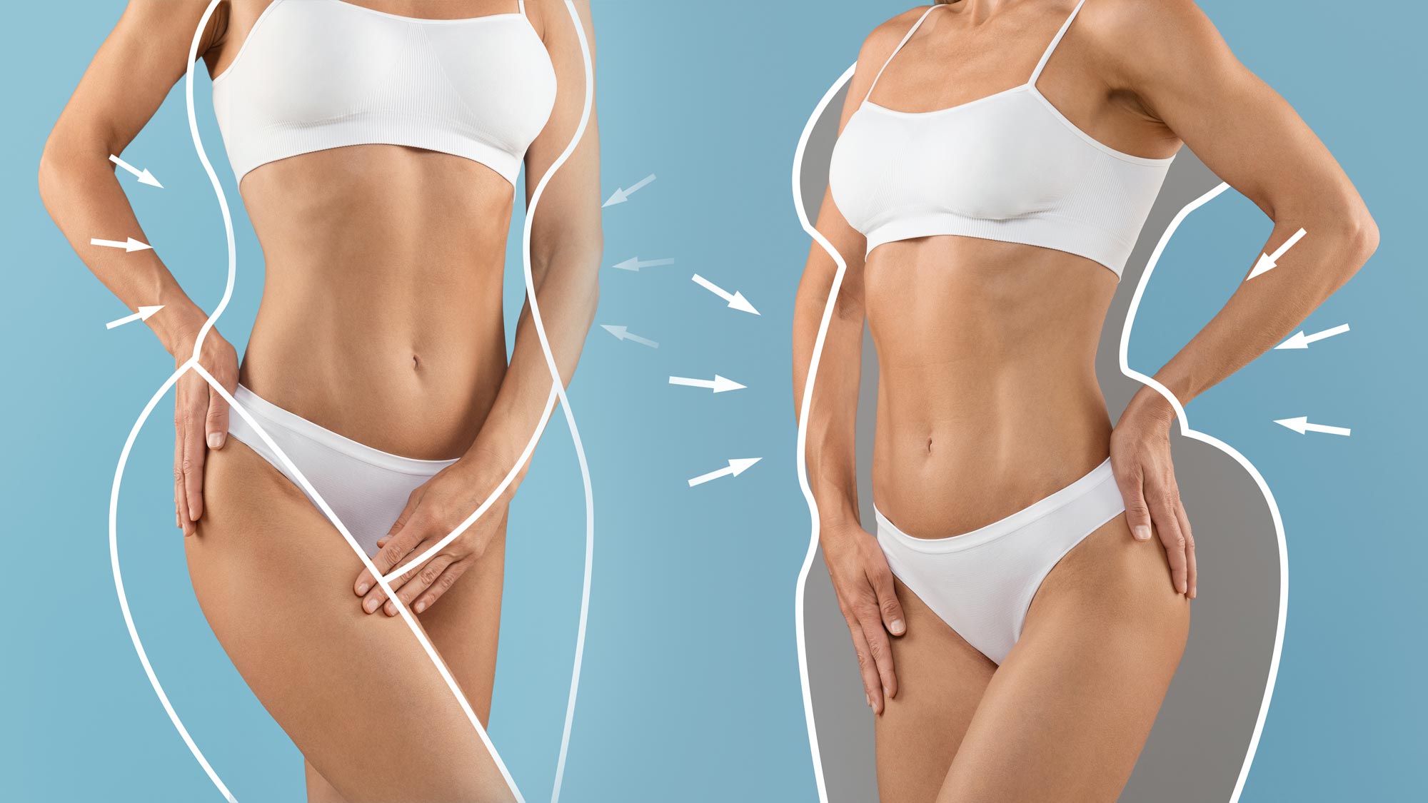 Best Lipo 360 in South Florida