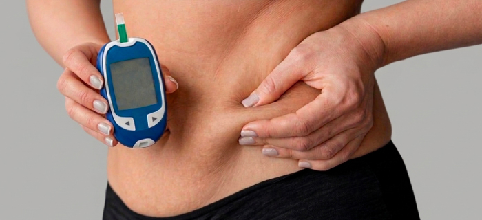 Can you get a tummy tuck