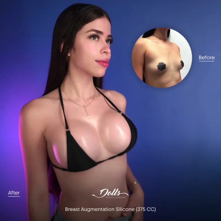 BAM Silicone Berman 3