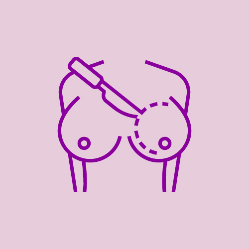 Reconstructive Option