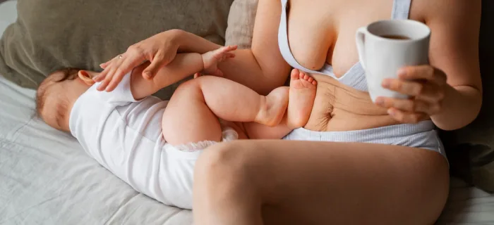 Mommy Makeover Surgery: Comprehensive Guide