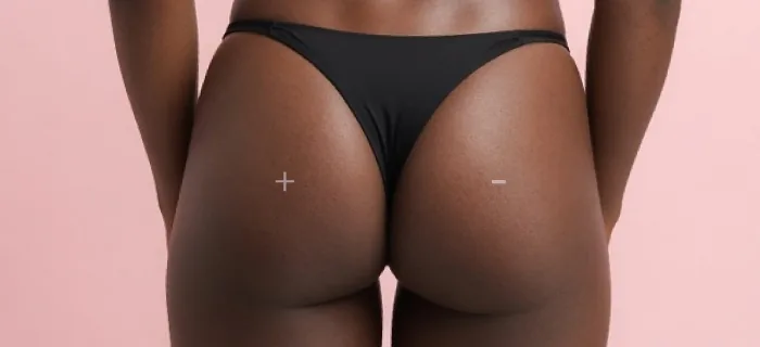 Pros and Cons of Brazilian Butt Lifts