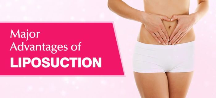 health benefits of liposuction surgery