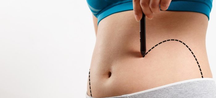 mommy makeover surgery overview
