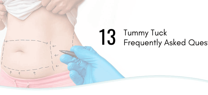 tummy tuck faq