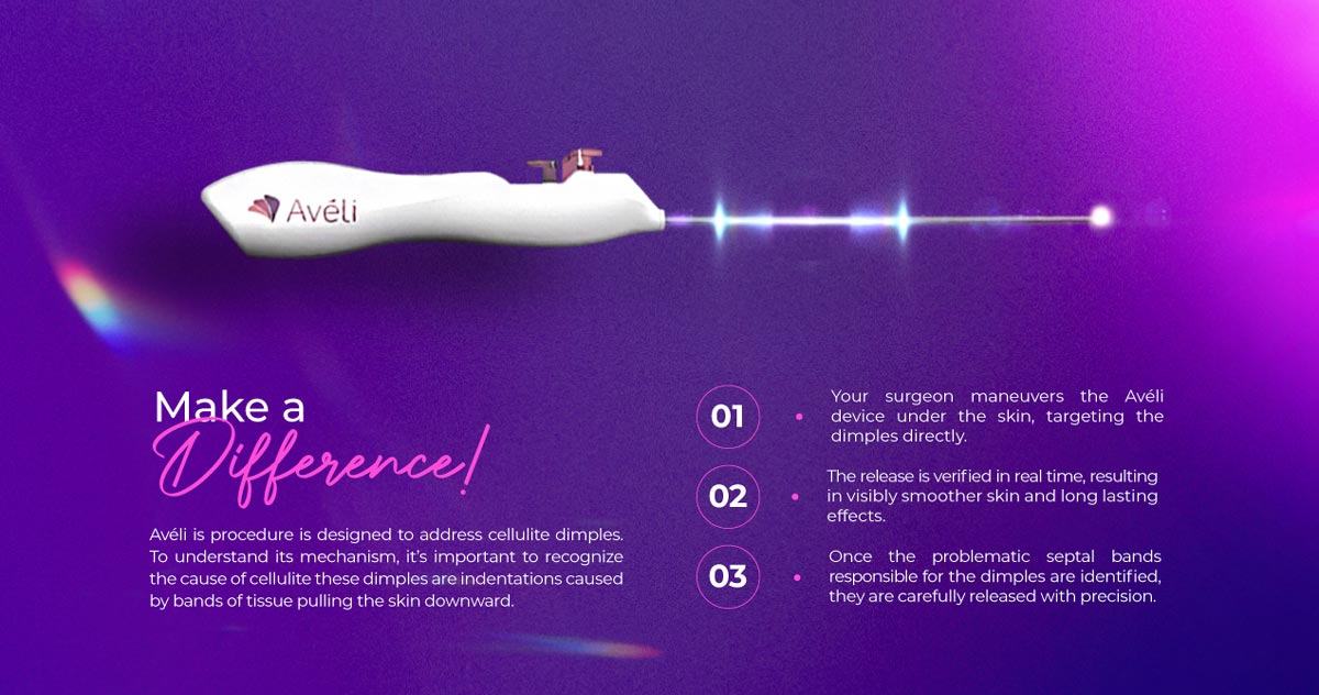 Aveli Cellulite Treatment